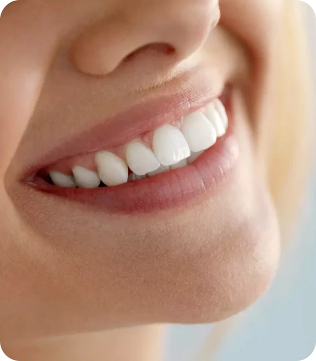 sourire eclaircissement dentaire Éclaircissement interne Cabinet d’Endodontie Lillois