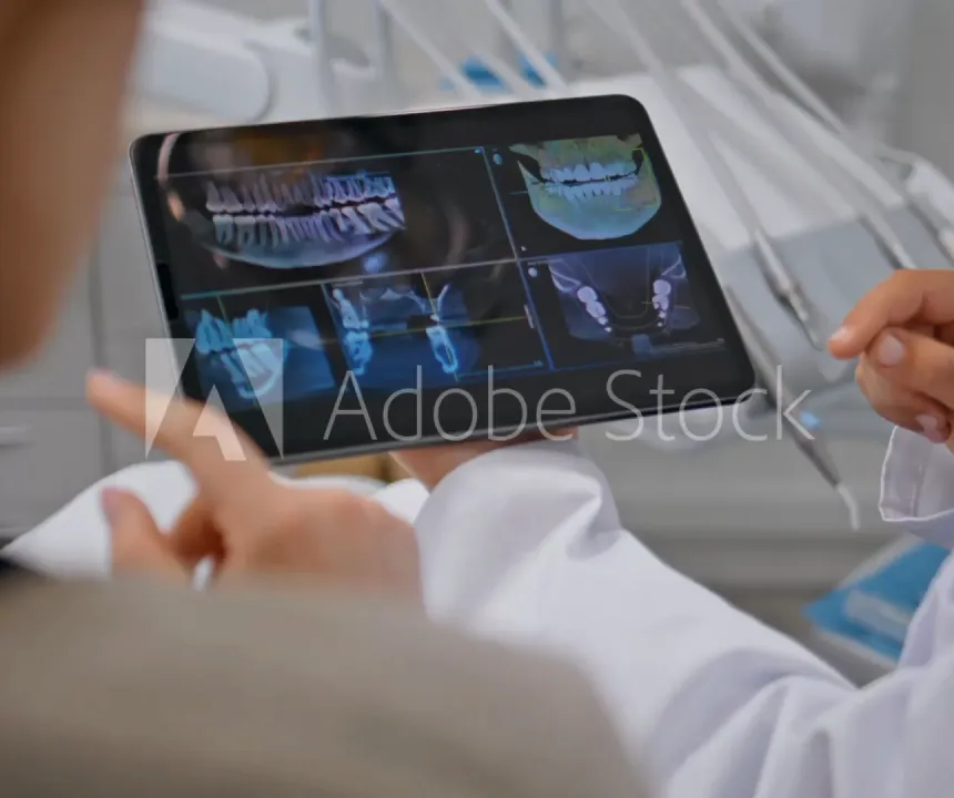 traitement endodontique canaux complexes Prise en charge de votre patient Cabinet d’Endodontie Lillois