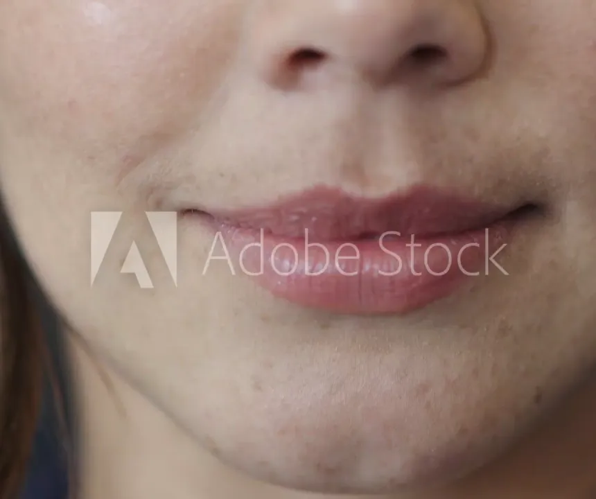 traitement endodontique digue securite Prise en charge de votre patient Cabinet d’Endodontie Lillois