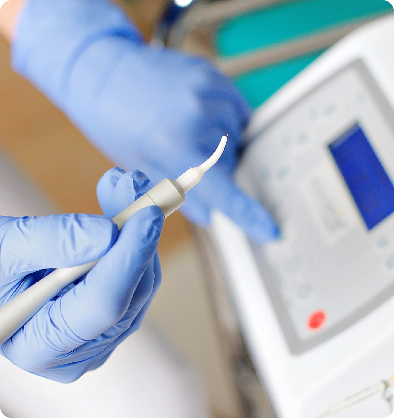 retraitement endodontique instruments fractures Notre cabinet Cabinet d’Endodontie Lillois